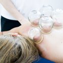 cupping-therapy-6604217_1280